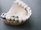 Jaw layout ceramic metal denture dental prosthesis