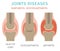 Joints diseases. Arthritis, osteoarthritis symptoms, treatment i