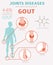 Joints diseases. Gout symptoms, treatment icon set. Medical info