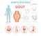 Joints diseases. Gout symptoms, treatment icon set. Medical info