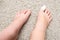 Kid teenager bare feet with a bandage on a toe, wounded toe or ingrown nail first aid