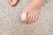 Kid teenager bare foot with a bandage on a toe, wounded injured toe or ingrown nail first aid