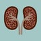Kidney disease silhouette icon. Stones in the kidneys. Pyelonephritis. Urolithiasis disease