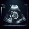 Kidney ultrasound, no text. ai generative