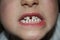 Kids teeths - closeup look