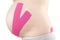 Kinesio tape on pregnant.