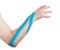 Kinesio tex tape therapeutic treatment of the elbow