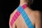 Kinesiological tape on the back of a young woman.