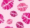 Kiss pattern