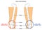 Knee joint anatomy infographic diagram anterior posterior views