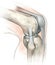 Knee joint, medical illustration