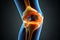 Knee meniscus, knee injury. Black background.