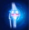 Knee Osteoarthritis abstract blue background