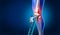 Knee Pain Care
