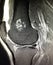 Knee pathology chondroid lesion enchondroma mri