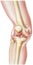 Knee - Rheumatoid Arthritis