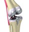 Knee and titanium hinge joint