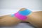 Knee treated with kinesio tex tape therapy. Injured woman knee with tratament of kinesio tape