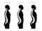 Kyphosis, lordosis flat vector illustration.