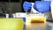 Laboratory researcher or nurse pipets patient sample into a test tube. Genetic engineering or genetic disease screening. Cancer an