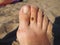 A ladybug beetle crawls on its toes. Women& x27;s foot on the background of beach sand. Healthy nail without onychomycosis