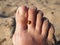 A ladybug beetle crawls on its toes. Women's foot on the background of beach sand. Healthy nail without onychomycosis