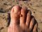 A ladybug beetle crawls on its toes. Women's foot on the background of beach sand. Healthy nail without onychomycosis