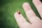 Ladybug in Child\'s Hand