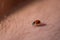 Ladybug crawling between hair on a person`s arm