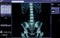 Lambar spine 3D render isolated on medical the screen