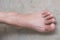 Lap Feet Or Flat Foot