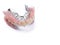 Large image of a modern denture on a white background