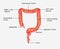 Large intestine labelled