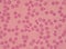 Large platelets on blood smear.