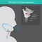 The Larynx. The mechanism for generating the human voice can be subdivided into 3 parts from air in lungs, passed the larynx