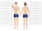 Laser hair removal male zones. Area body depilation Men. Front and back