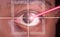 Laser or lasik eye surgery concept, laser beam shining into african america male dark brown eyes