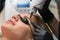 Laser removal of permanent makeup. The beautician removes the tattoo from the eyebrows