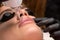 Laser removal of permanent makeup. The beautician removes the tattoo from the lips
