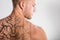 Laser Tattoo Removal On Man`s Back