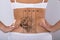 Laser Tattoo Removal On Woman`s Hip