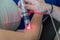 Laser therapy in hand used to treat pain.