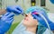 Laser vaporization of nasal concha with coblation technology method