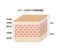 Layer of human damaged skin 3D illustration / Japanese