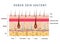 Layered epidermis, human skin anatomy