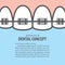 Layout closeup braces upper teeth illustration vector on blue ba