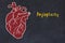 Learning cardio system concept. Chalk drawing of human heart and inscription Angioplasty