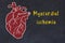 Learning cardio system concept. Chalk drawing of human heart and inscription Myocardial ischemia