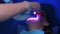 LED whitening beauty cosmetic procedure for woman`s teeth in dentistry clinic.