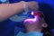 LED whitening beauty cosmetic procedure for woman`s teeth in dentistry clinic.